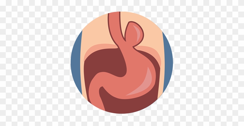 Normal Anatomy Consists Of The The Esophagus Traversing - Illustration #807587