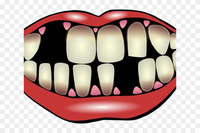 Loose Tooth Cliparts - Cause And Effect Visual Cards #854570