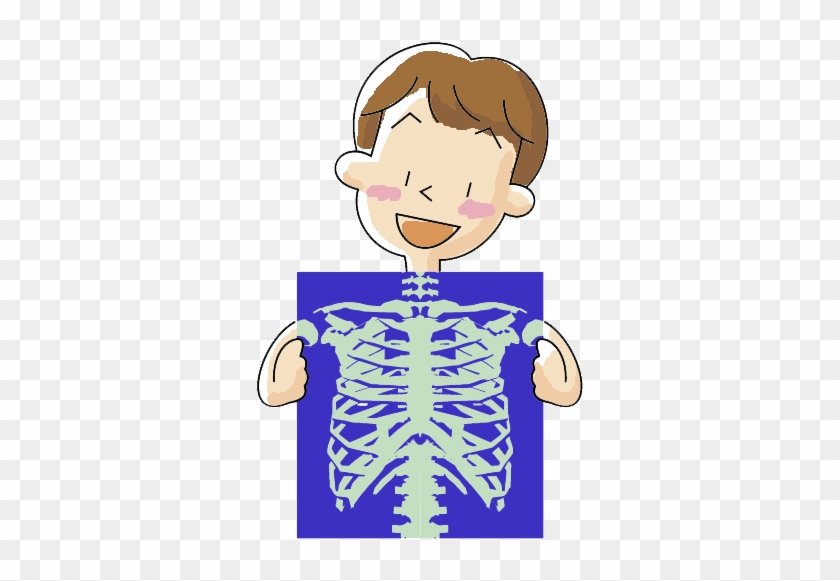 X - X Ray Clipart Free #872817