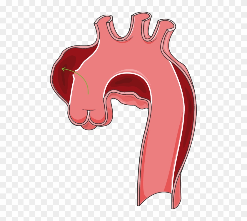 Arteries - Arteries #919513