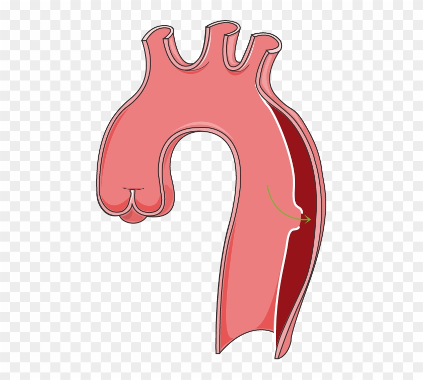 Arteries - Arteries #919514