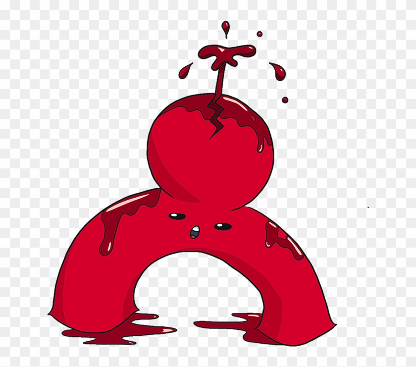 Aneurysm1 - Aneurysm1 #972519