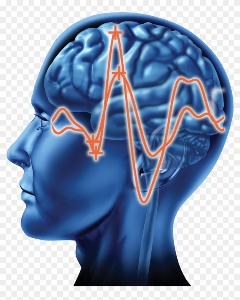 Research On Visual Evoked Potential And Mild Traumatic - Brain #1079089