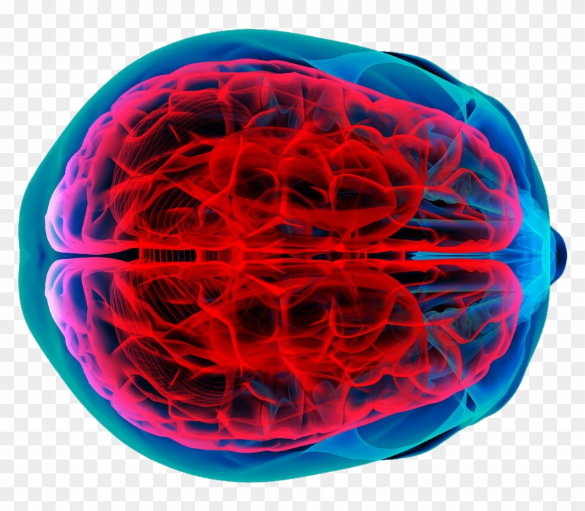 Brain Tumor Human Brain Brain Mapping Cancer - Usmle Step 3 Lecture Notes 2017-2018 (ebook) #1079177