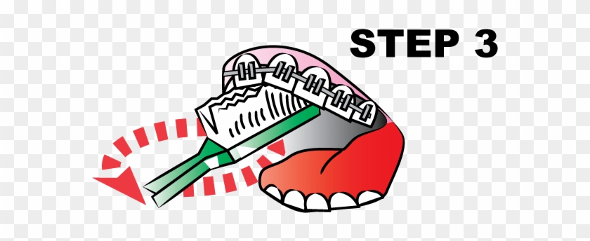 Make Sure You Slowly Brush Every Tooth And The Arches - Tooth Brushing #1080767
