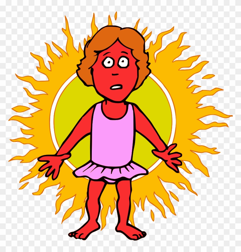 Sunburn Clipart #1182399