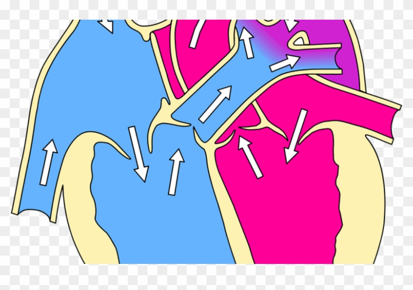 Common Misconceptions About Cardiovascular Disease - Patent Ductus Arteriosus Meaning #1238332