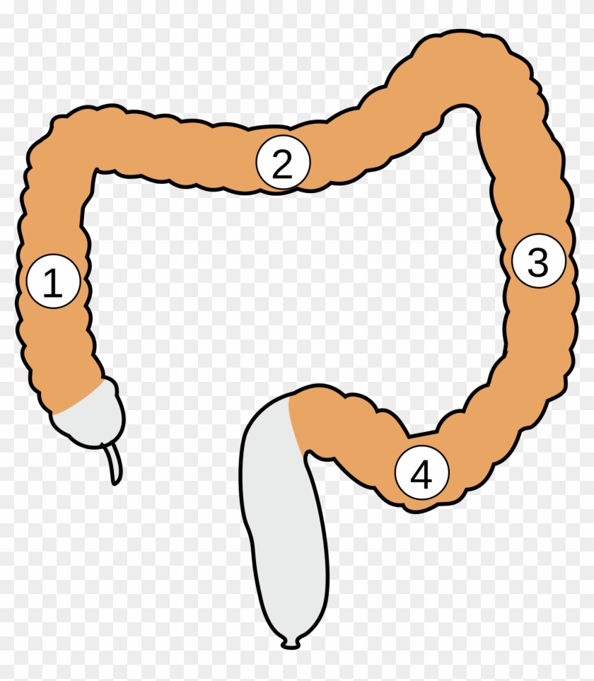 Open - Large Intestine #1241404