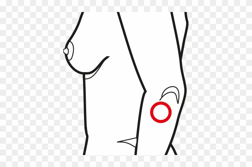 Epicondylitis - Tennis Elbow #1256457