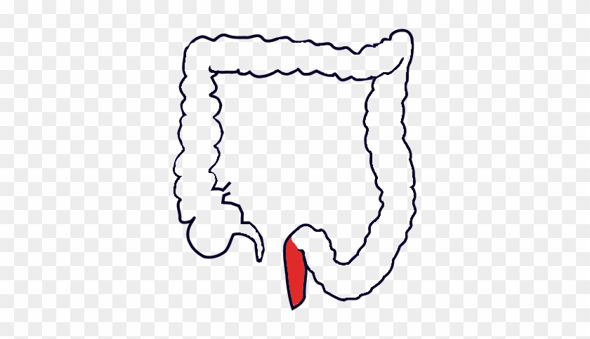 A Place Where Feces Is Stored For Some Time Before - Dog Appendix #1278873