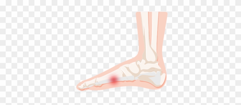Feet Clipart Foot Heel - Sock #1298549