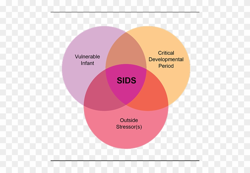 The Triple-risk Model For Understanding Sids Deaths - Sids Triple Risk Model #1310202