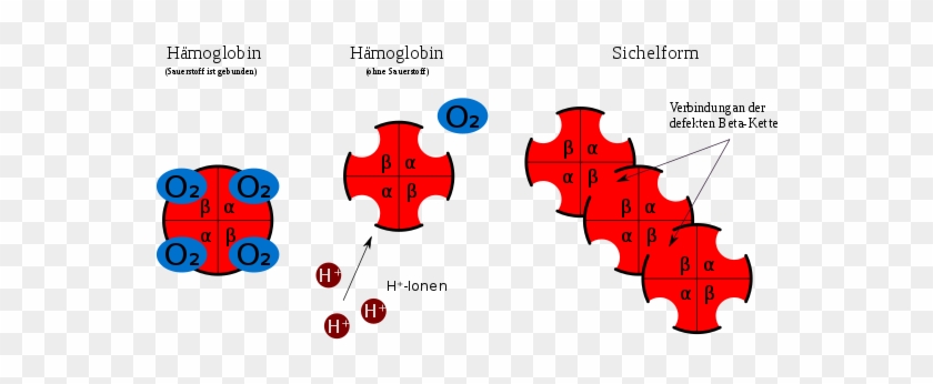 Bedeutung Der Sichelzellanämie Für Malaria[bearbeiten - Hämoglobin Sichelzellanämie #1323826