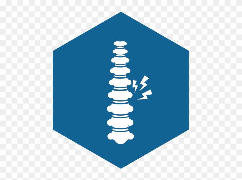Cervical Myelopathy - Cervical Myelopathy #1356393
