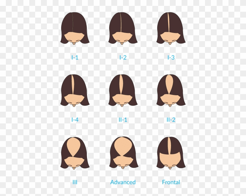 Instead, The Hair Follicles Become Sensitive To Normal - Instead, The Hair Follicles Become Sensitive To Normal #1380037
