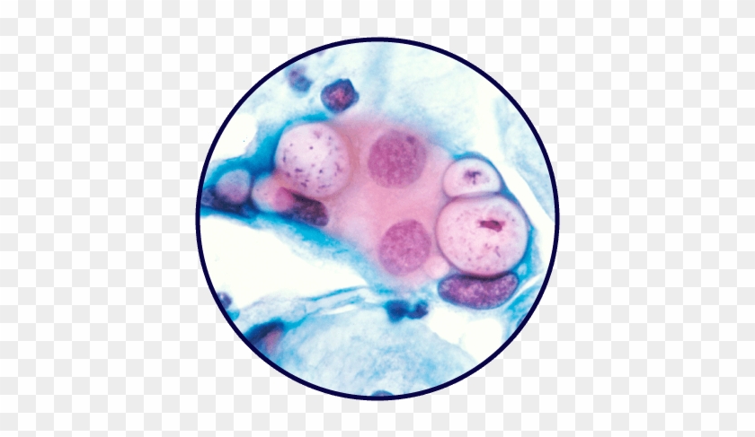 Chlamydia-circle420 - Chlamydias Trachomatis #1443557