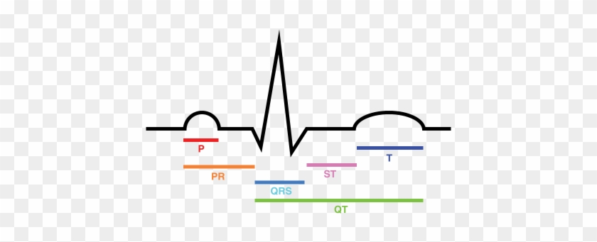File - Ecg Intervals - Svg - Sa Node Damage On Ecg #1469061