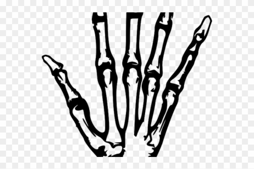 X Ray Clipart Svg - X Ray Clipart Svg #1508369