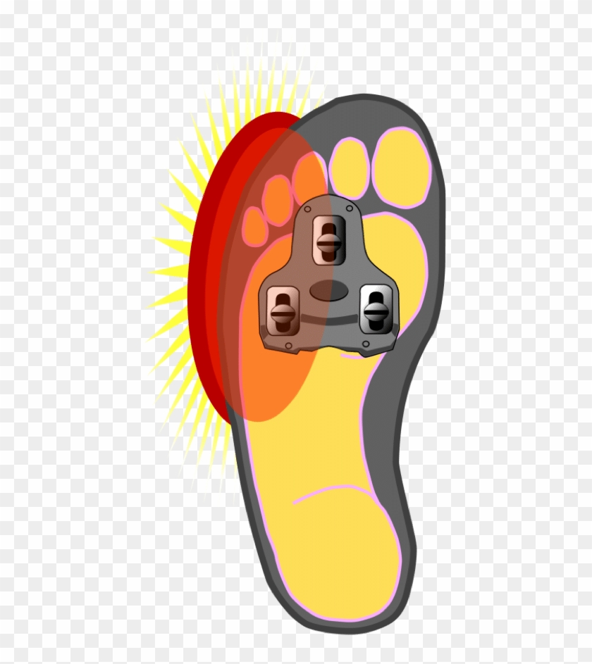 Hurt Clipart Foot Pain - Hurt Clipart Foot Pain #1508392