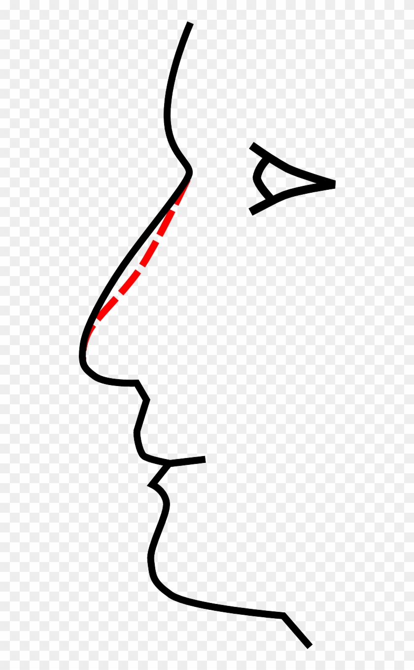Plastic Surgery, Rhinoplasty - Plastic Surgery, Rhinoplasty #1569333