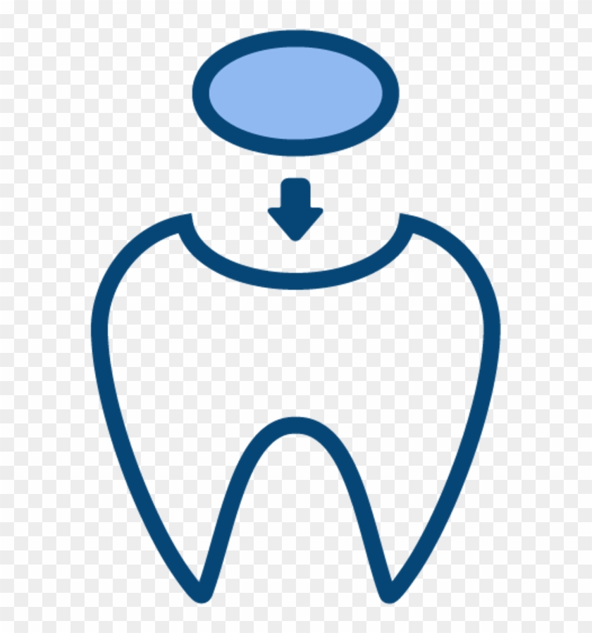 When Cavities Gets Through The Enamel And Enters The - When Cavities Gets Through The Enamel And Enters The #1582512
