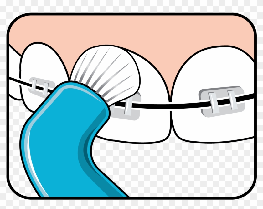 Effective Cleaning Along The Gum Line - Effective Cleaning Along The Gum Line #1586746