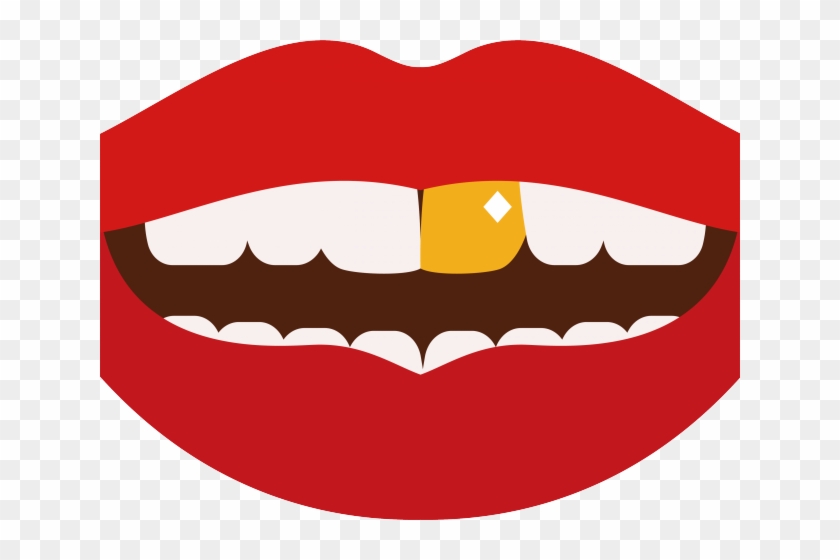 Lips Clipart Juicy Lip - Girl With Gold Teeth Clipart #1660007