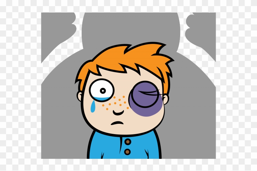 Fighting Clipart Hurt Eye - Cartoon Physical Bullying Bullied #1664621