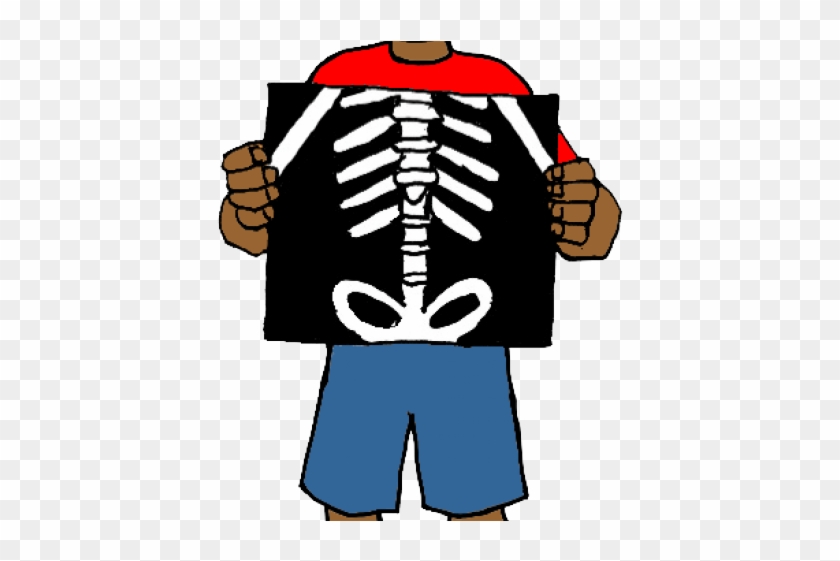 Original - X Ray Clipart Png #1727256