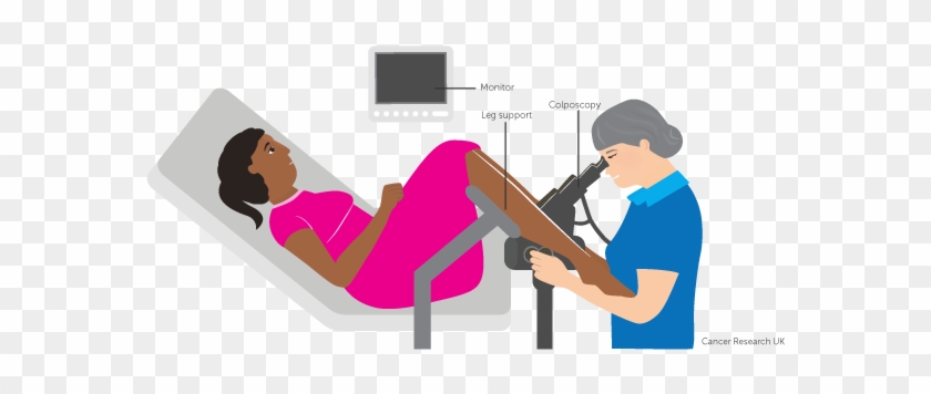 Diagram Of A Colposcopy - Colposcopy Diagram #1762772